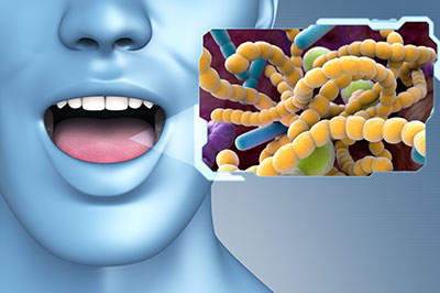 The image features a 3D rendering of a human head with an open mouth, set against a background that includes a microscopic view of bacteria or viruses. An  alt  tag description for accessibility purposes could be   A digital artwork showing a human mouth and a close-up of bacterial cells.