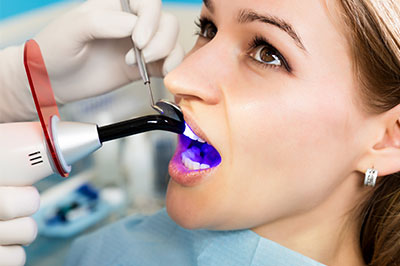 Woman receiving dental care with blue light illuminated on her teeth.