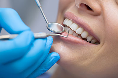 This image depicts a dental professional performing oral care on a patient s teeth, with the patient smiling and wearing protective blue gloves.