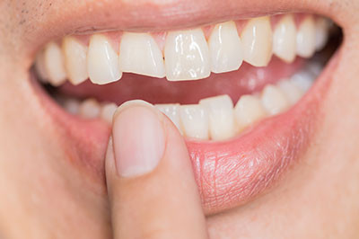 The image shows a close-up of a person with an open mouth, displaying teeth and gums, while holding a finger near their lips.