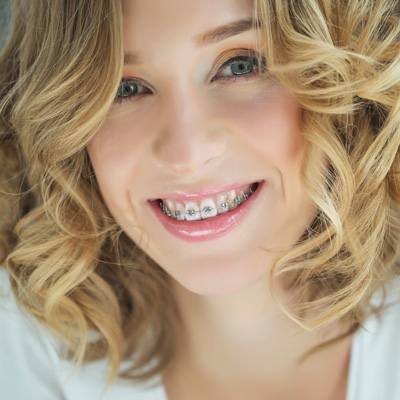 The image shows a woman with light-colored hair styled in waves, smiling at the camera with her teeth visible, wearing braces. She has a fair complexion and is looking directly at the viewer.